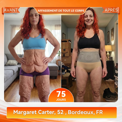 Boutique Officielle de la Marque 💎 𝑨𝑳𝑳𝒀𝑩𝑬𝑬® 2026 Moringa & Berbérine 4-en-1 Micro-Particules Sculptantes & Brûlantes de Graisse Shorts